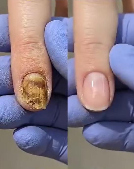 3 Days Nail Care Keratin Amino Acids 16ml (Pack of 1)